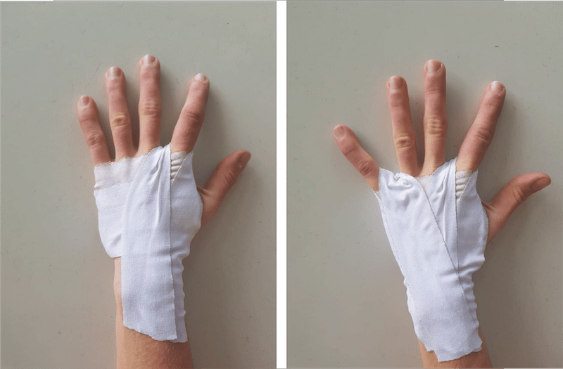 hand with bandage