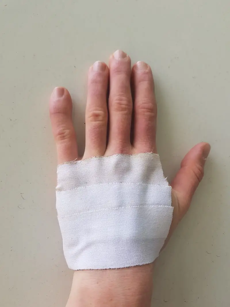 hand with bandage