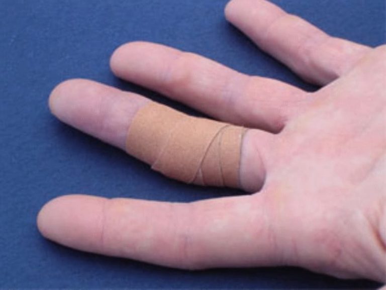 How To Tape Fingers For Climbing Both Fingertips & Hands