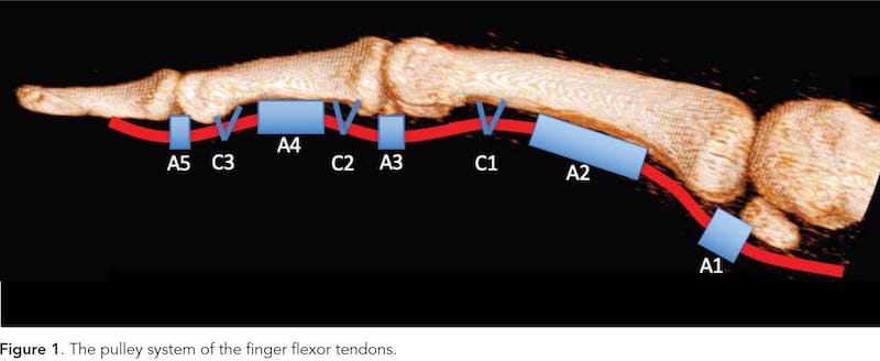 picture of bones